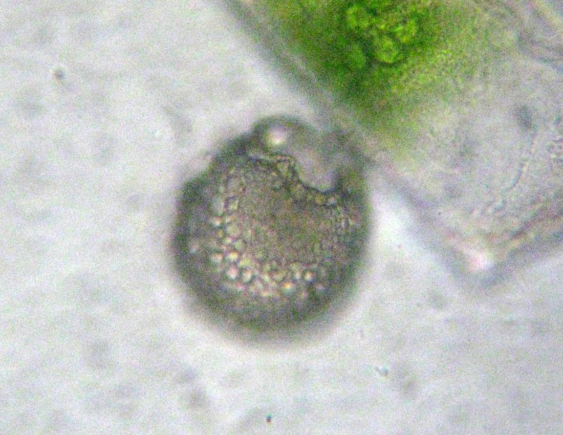 Difflugia verosimilmente gramen